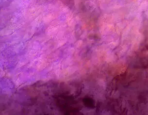 Lactobacillus
