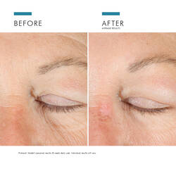 A.G.E. Advanced Eye mod mørke rande