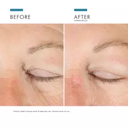 A.G.E. Advanced Eye mod mørke rande